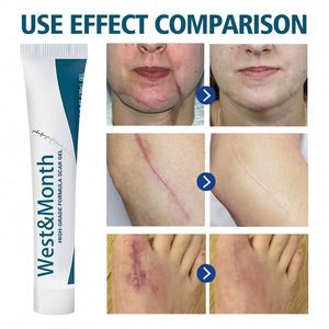 Gel réparateur cutané en gros pour cicatrices de chirurgie et de <span class=keywords><strong>grossesse</strong></span>, lissant la peau, 20g - Product Image 3