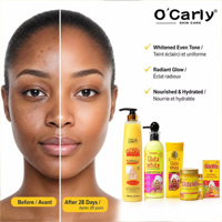Ensemble de soins de la peau O'Carly Guta, blanchissant, hydratant, éclaircissant, anti-âge, vitamine C, nicotinamide, élimination des taches brunes, 5 en 1