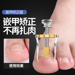 Nail groove corrector, pedicure tool, nail straightener, ingrown toenail clipper, nail clipper for correcting ingrown toenails - Product Image 3