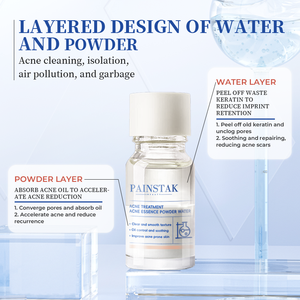 เซรั่มบำรุงสิว<span class=keywords><strong>ผง</strong></span>น้ำสูตรพิเศษรักษาสิวมีประสิทธิภาพความเร็วสูง - Product Image 4