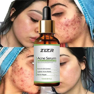 Sérum de soin de la peau 100% naturel à étiquette privée en gros, sérum anti-acné, contrôle de l'huile, éclaircissement des marques d'acné, réparation de la barrière cutanée - Product Image 1