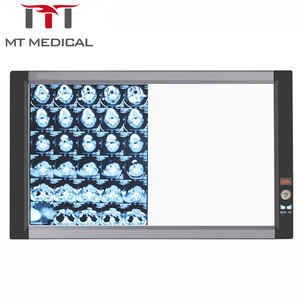 Visualizzatore di pellicole mediche MT MEDICAL di alta qualità, ultra sottile, a doppio <span class=keywords><strong>LED</strong></span>, per raggi <span class=keywords><strong>X</strong></span>, con controllo digitale completo. - Product Image 1