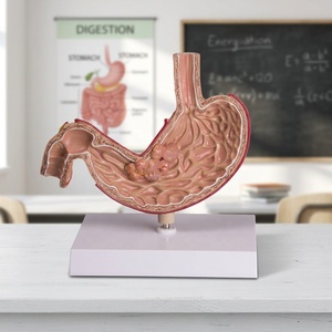 Modelo de Estómago Patológico Humano con Úlcera Cancerosa e Inflamación, para Educación del Paciente, Maniquí Médico - Product Image 4