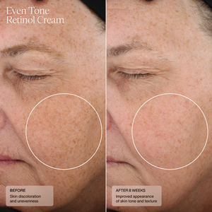 Crema facial nutritiva orgánica de 55ml para eliminar arrugas, crema facial de colágeno de retinol antienvejecimiento con vitamina de ácido hialurónico - Product Image 4