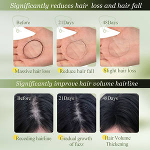 Private Label <span class=keywords><strong>fatto</strong></span> <span class=keywords><strong>in</strong></span> <span class=keywords><strong>casa</strong></span> a base <span class=keywords><strong>di</strong></span> erbe vegane oliva Jojoba ricino rosmarino Avocado e menta piperita <span class=keywords><strong>olio</strong></span> per la crescita dei capelli per gli uomini - Product Image 6