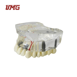 Modelo de Dientes de Práctica para Implantes Dentales UMG UM-2006, Mandíbula Inferior, para Incisión y Perforación, Calidad Superior Duradera - Product Image 3