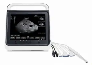 Portable Ultrasound Machine Medical USG PW CW DICOM Cardiac Probe Cardiology For Hospital Clinic