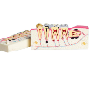 Modelo de Descomposición de Tejido de la Mandíbula Inferior Derecha |   Modelo de Anatomía del Diente del Sabiduría para Entrenamiento, Educación y Exámenes en Clínicas Dentales - Product Image 4