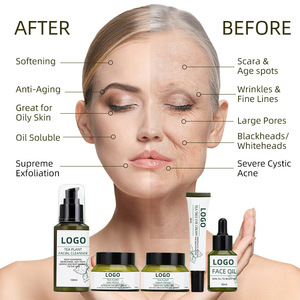 Kit de Soins de la Peau le Plus Vendu : Crème de Nuit Éclaircissante et Régulatrice de Sébum à la Plante du Thé avec Marque Privée - Product Image 6