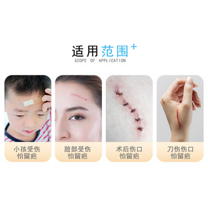 Venda elástica de 2 correas, dispositivo de sutura cutánea, vendaje con cierre tipo cremallera, reductor de tensión, vendaje postoperatorio sin sutura - Product Image 5