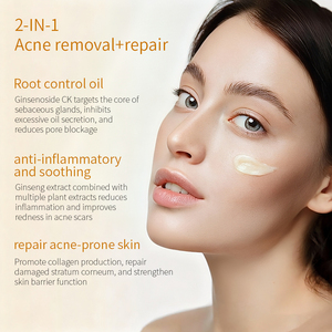 Crema per il Trattamento dell'Acne con Estratto di Radice di Ginseng OEM/ODM |   Olio Naturale a Base di Erbe per il Controllo del Sebo e Anti-infiammatorio |   Arbutina Certificata GMP 50ml - Product Image 3
