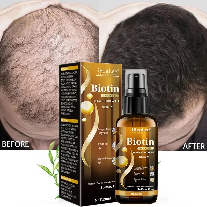 Private Label Organic Natural Fast Growing Strengthening Repair Treatment Biotin Regrowth Serum Rosemary Hair Growth Oil Spray