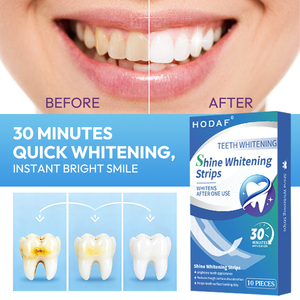 Strisce Sbiancanti per Denti all'Ingrosso, Corso di 14/28 Giorni per una Trasformazione Completa del Sorriso - Product Image 3