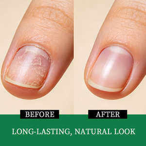 Crema Removedora de Cutículas OEM/ODM, Cuidado de las Uñas, Hidratante, Elimina la Piel Muerta, Crema para Cutículas de Uñas Secas para Manicura - Product Image 2