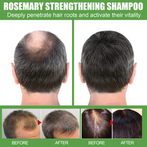 Champú de Romero Limpieza profunda Masaje cuero cabelludo <span class=keywords><strong>Hidratante</strong></span> champú suave para cabello denso - Product Image 5