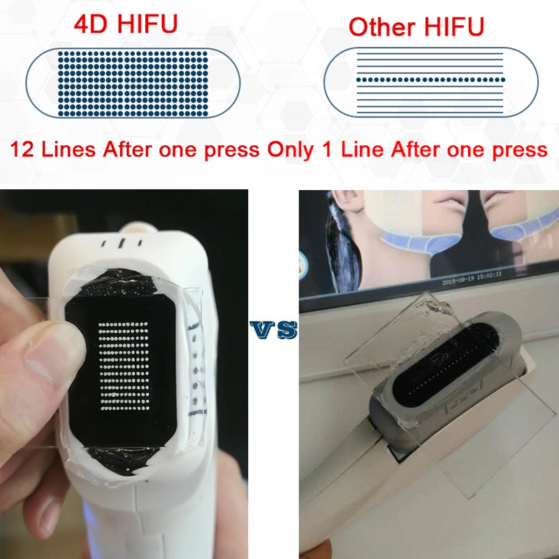 12 Lines 4D Ultra Face Lifting Body Slimming Machine Ultrasound  Skin Tightening
