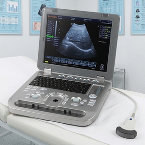 Échographe portable 2D/3D de diagnostic médical électrique de haute qualité - Product Image 1