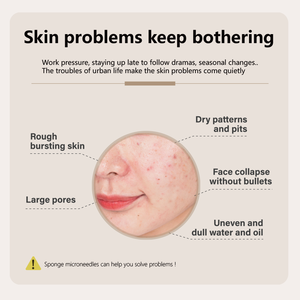 G สาหร่ายชุดบำรุงผิวสำหรับรักษาสิว<span class=keywords><strong>ฝ้า</strong></span>ทำให้ผิวขาวหน้ากากซิ<span class=keywords><strong>ล</strong></span>ิโคนแบบเข็ม - Product Image 3