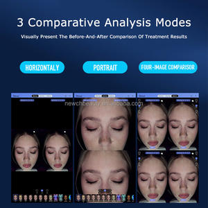 Haute qualité 3D imagerie faciale Scanner spectre beauté équipement testeur de peau humidité analyse faciale analyseur de peau Machine - Product Image 5