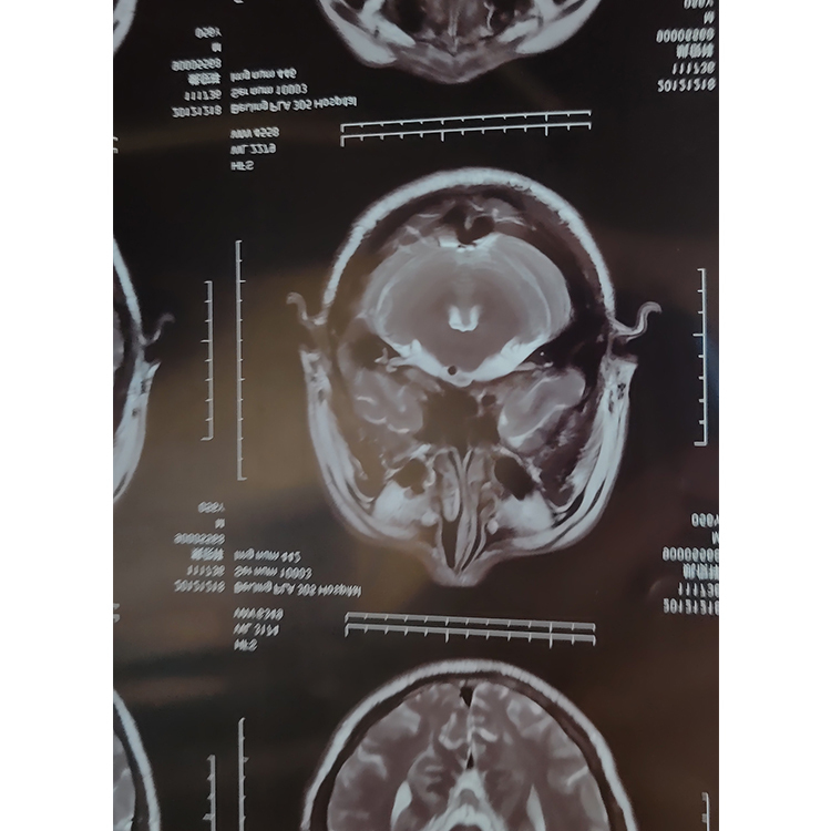 Medical Dry Imaging Film DI-HT