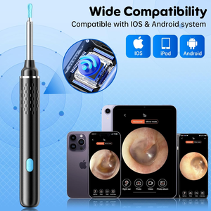 Meilleures ventes : Nettoyeur d'oreilles intelligent avec caméra HD, sans fil, WiFi, contrô<span class=keywords><strong>le</strong></span> par application, sûr et efficace - Product Image 6