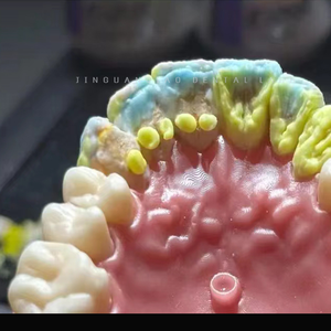 Dentiera denti finti fissi Zirconia denti corone & ponti laboratorio dentale cinese con la migliore qualità - Product Image 3