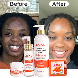 Kit de Soins Visage 4-en-1 <span class=keywords><strong>Anti</strong></span>-Imperfections et Éclaircissant pour Peaux Africaines – Marque Blanche - Product Image 1