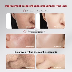 Crema Blanqueadora de Glicerina <span class=keywords><strong>Princess</strong></span> para Eliminar Pecas, Nutre la Piel del Rostro, Atenúa Manchas Oscuras, Ilumina la Complexión - Product Image 3