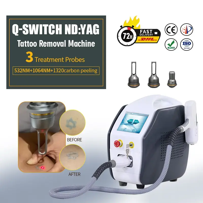KES nd yag laser Q-switch NdYag laser High Power Tattoo Removal Machine laser q-switched for salon