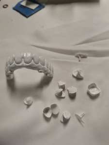 Pasta di Zirconia per Modelli Dentali, Denti Stampati in 3D, Corone Dentali Dopo Disincrostazione e Sinterizzazione - Product Image 5