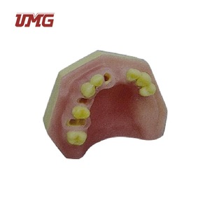 Zahnmedizinisches Anatomisches Modell für Sofortige Implantationspraxis in der Medizinischen Wissenschaft <span class=keywords><strong>UMG</strong></span> UM-2044 - Product Image 3