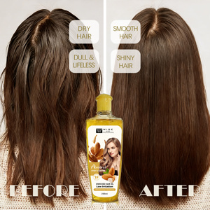 <span class=keywords><strong>Aceite</strong></span> Capilar <span class=keywords><strong>de</strong></span> <span class=keywords><strong>Almendras</strong></span> 200ml, Tratamiento Orgánico para el Cuidado del Cabello, Suero Acondicionador Profundo que Suaviza el Cabello, Marca Privada OEM - Product Image 5