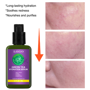 Ensemble de soins de la peau au thé vert ODM/OEM pour le contrôle du sébum, le traitement de l'acné, le resserrement des pores, l'anti-inflammatoire, la apaisement des peaux sensibles, l'hydratation en profondeur - Product Image 4