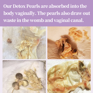 Perlas Detox Yoni 100% Herbales para Control de Olores, Tratamiento para Infecciones por Hongos TTC, Candidiasis, Vaginosis Bacteriana (VB) ISO 9001 - Product Image 6