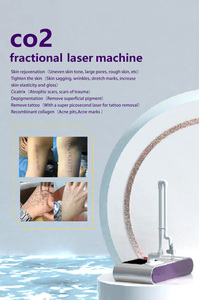 Machine à laser fractionné CO2 10600 nm pour l'élimination des tatouages, le resserrement vaginal, la gravure au laser CO2, la machine à laser CO2 Zixia Fairy - Product Image 2