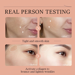 Sérum facial au rétinol pour les rides profondes avec acide ascorbique, sérum anti-âge pour les ridules, les taches brunes, les cicatrices post-acné - Product Image 5