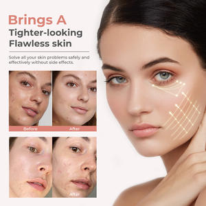 Dispositivo Portátil Antienvejecimiento, Herramienta Eléctrica de Reafirmación y Calentamiento de <span class=keywords><strong>la</strong></span> Piel <span class=keywords><strong>para</strong></span> <span class=keywords><strong>la</strong></span> Absorción de Colágeno en Rostro y Cuerpo - Product Image 6