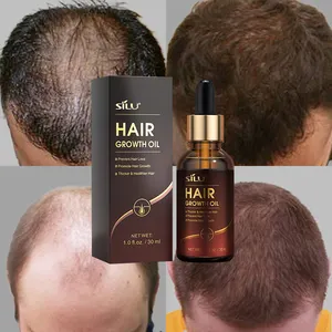 Private label 100ml activator scalp treatment castor oil hair growth serum for black hair