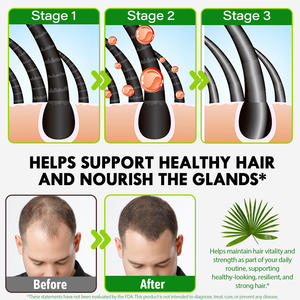 300粒植物提取物4000毫克锯棕榈叶提取物软胶囊支持前列腺健康荷尔蒙平衡锯棕榈软胶囊 - Product Image 3