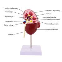 Modelo de Riñón Patológico y Normal - Simulación de Enseñanza de Urología, Modelo de Anatomía y Estructura del Riñón Humano