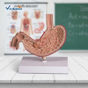 Modelo de Estómago Patológico Humano con Úlcera Cancerosa e Inflamación, para Educación del Paciente, Maniquí Médico - Product Image 2