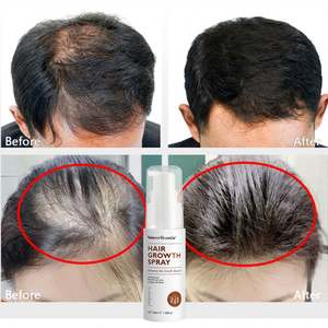 Suero para el crecimiento del cabello de Etiqueta Privada, efecto refrescante anticaspa rápido, extracto de jengibre vegano Panax Ginseng, nutre las raíces del cabello - Product Image 2