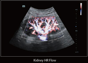 Ecógrafo <span class=keywords><strong>Mindray</strong></span> <span class=keywords><strong>DC</strong></span>-60Exp <span class=keywords><strong>DC</strong></span>-<span class=keywords><strong>70</strong></span>, Ecógrafo de Diagnóstico Médico <span class=keywords><strong>Mindray</strong></span>, Escáner de Ultrasonido Veterinario para Clínica Veterinaria y Hospital - Product Image 6