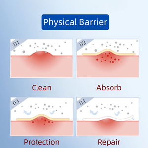สติ๊กเกอร์ OEM แผ่นแปะสิวที่ดีที่สุด แบรนด์ส่วนตัว แผ่นแปะไฮโดรคอลลอยด์สำหรับกำจัดสิว ปิดสิว และรักษารอยสิว - Product Image 4