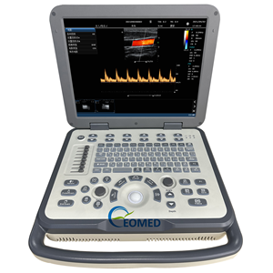 Mesin gema dokter manusia berkinerja tinggi dengan fokus dinamis waktu nyata & pengurangan kebisingan DopplerCU50 pencitraan Digital penuh - Product Image 1