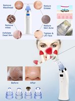 Appareil de nettoyage des pores à aspiration manuelle pour le visage et le nez, éliminateur de points noirs, 4 têtes, pour soins personnels