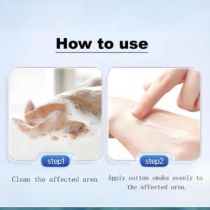 Усовершенствованная мягкая формула для защиты кожи от микробов-Успокаивающая бактериальная мазь для местного применения - Product Image 5