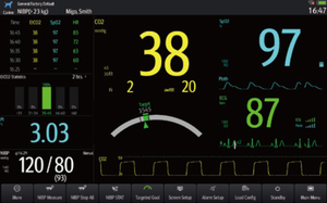 动物医院多参数监测仪EPM 12m兽医迈瑞兽医病人监测仪 - Product Image 5