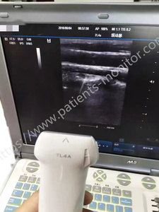 DC-6 <strong>Ultrasound</strong> 7L4A <strong>Ultrasound</strong> <strong>Probe</strong> Used-Good Condition 5.0/5.7MHz <strong>Doppler</strong> Frequency 35mm Scanning Angle For Clinical - Product Image 5