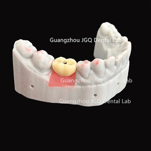 Dientes de cerámica de Zirconia completa <span class=keywords><strong>Implantes</strong></span> dentales Tornillo retenido China Buen <span class=keywords><strong>precio</strong></span> Dentaduras postizas - Product Image 2